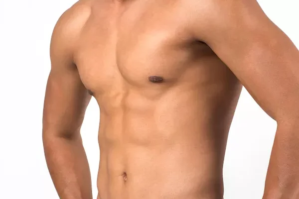Gynecomastia